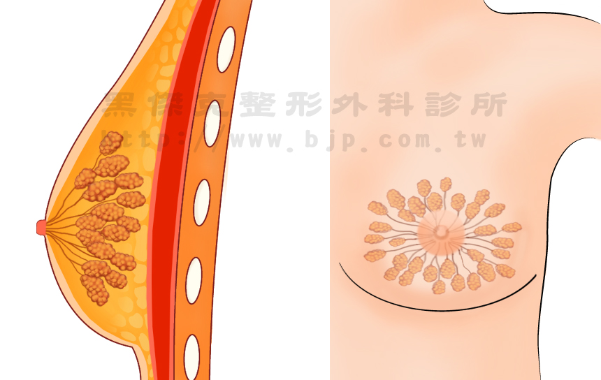 男性女乳症成因的相當複雜，但大多數都為體內女性激素較高，男性荷爾蒙較低，或是肥胖體格導致乳腺過度發育而引起