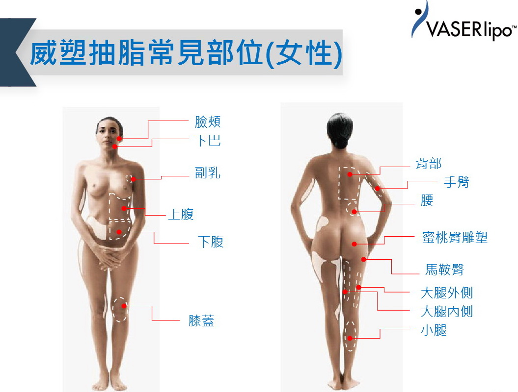 威塑抽脂，組織破壞低、出血量少