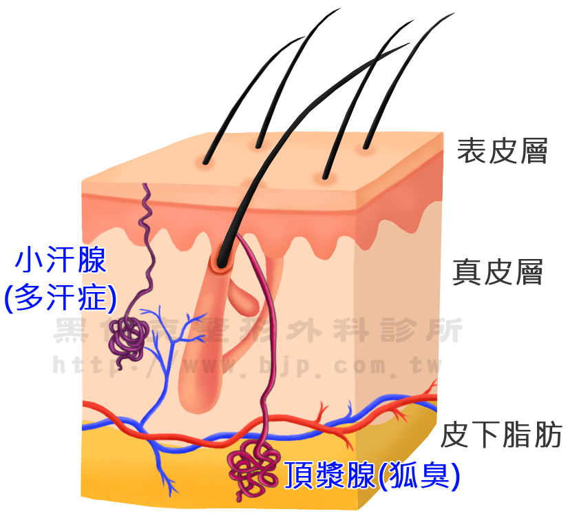 狐臭，主要是大汗腺分泌物(頂漿腺)與微生物作用之後的產物所散發出的特殊臭味(體味)。頂漿腺主要分布於腋下，在乳暈、外生殖器及肛門等處也有它的存在。