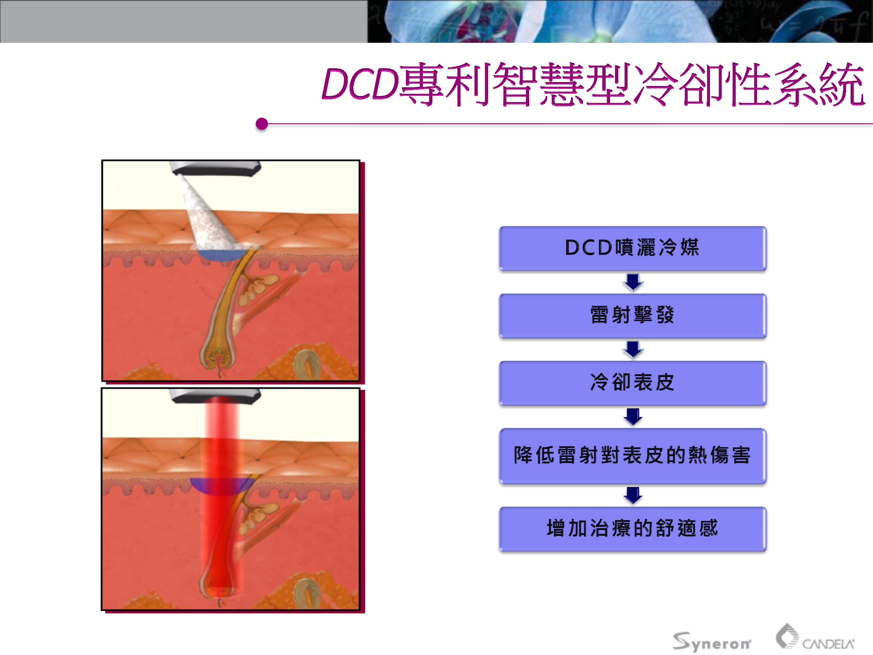 亞歷山大雷射，雷射能量穿透皮膚組織，光能被毛囊中的黑色素吸收轉換成熱能，破壞毛囊細胞，抑制毛髮後續的生長能力。