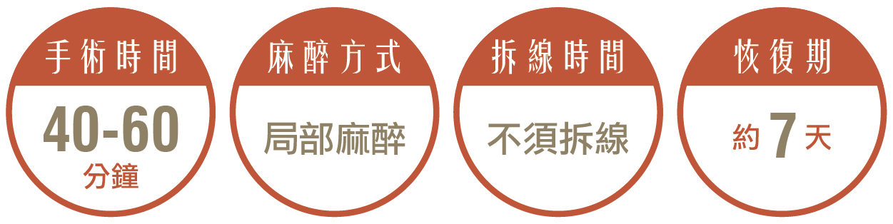 酒窩/梨渦手術，手術時間約40-60分鐘,麻醉方式採局部麻醉,術後不須拆線,恢復期約7天